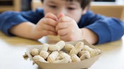 Viral,Early exposure,Children,Allergy ,Peanut,Viral,Early exposure,Children,Allergy ,Peanut,Viral,Early exposure,Children,Allergy ,Peanut,Viral,Early exposure,Children,Allergy ,Peanut,